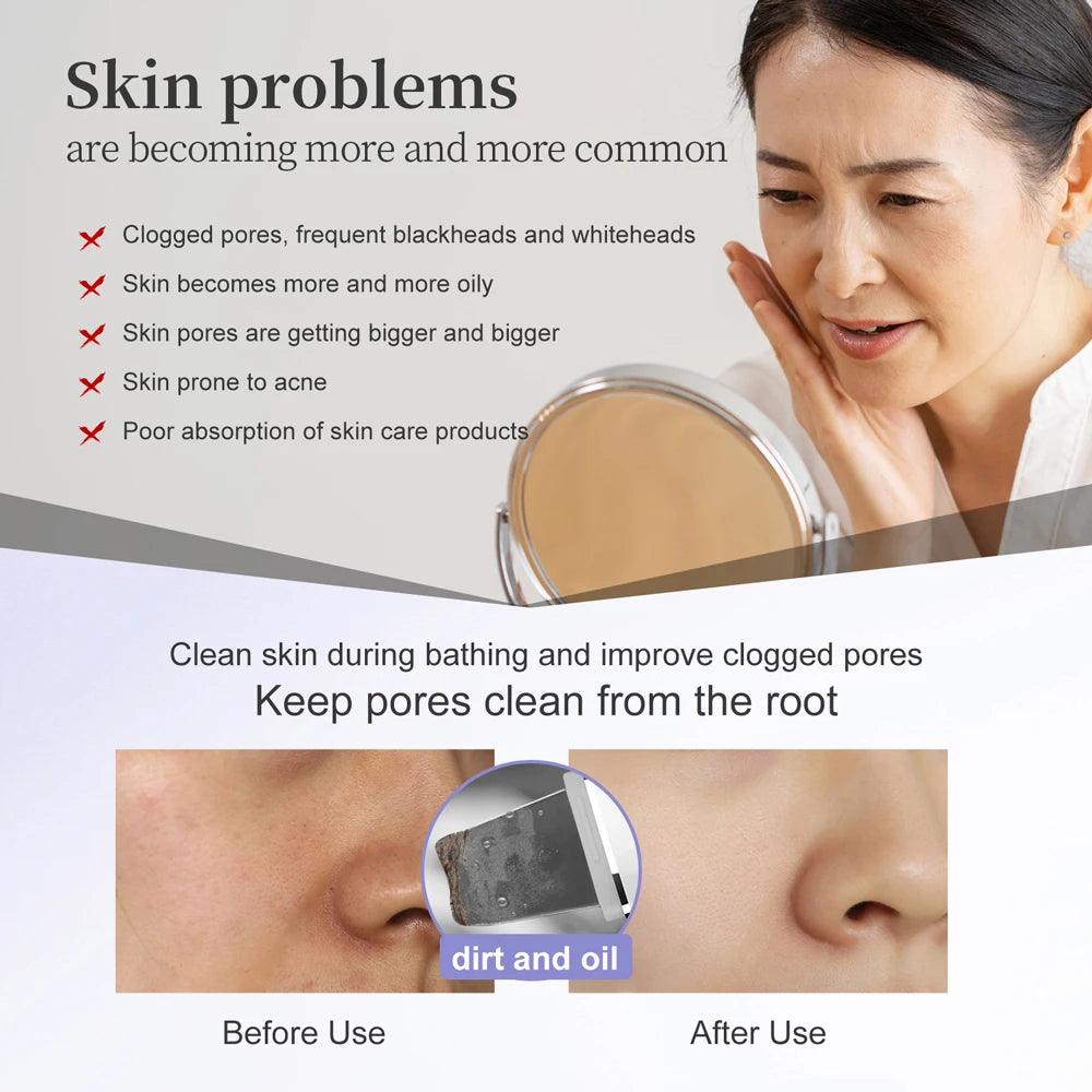 Anlan超声皮肤洗涤器