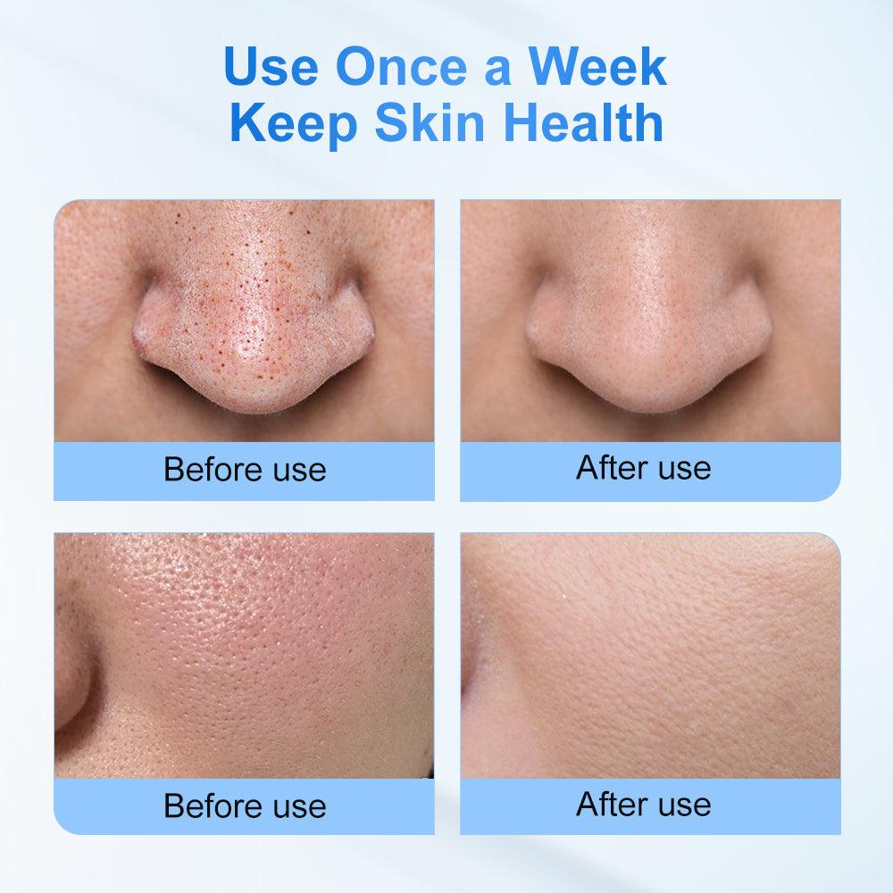 before use & after use